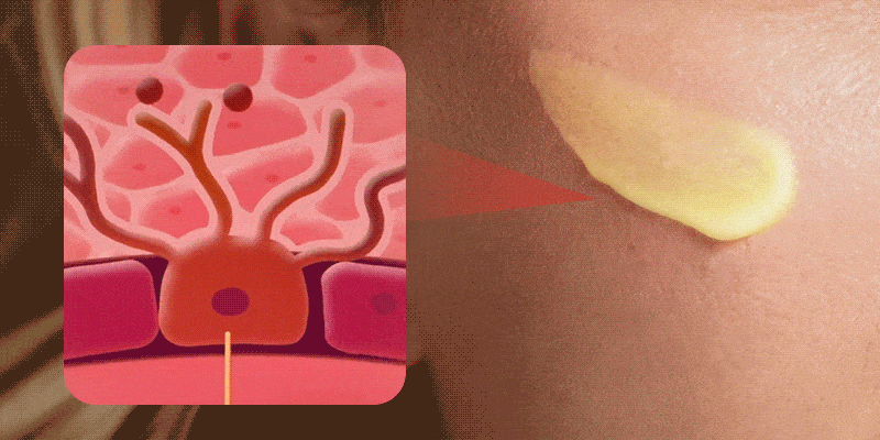 Animated infographic showing Night Essence targeting the root cause of dark spots